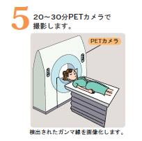 PET/CT検査の流れ　5