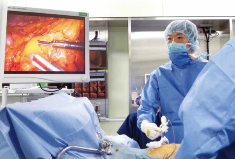 消化器のがんに対する腹腔鏡手術について
