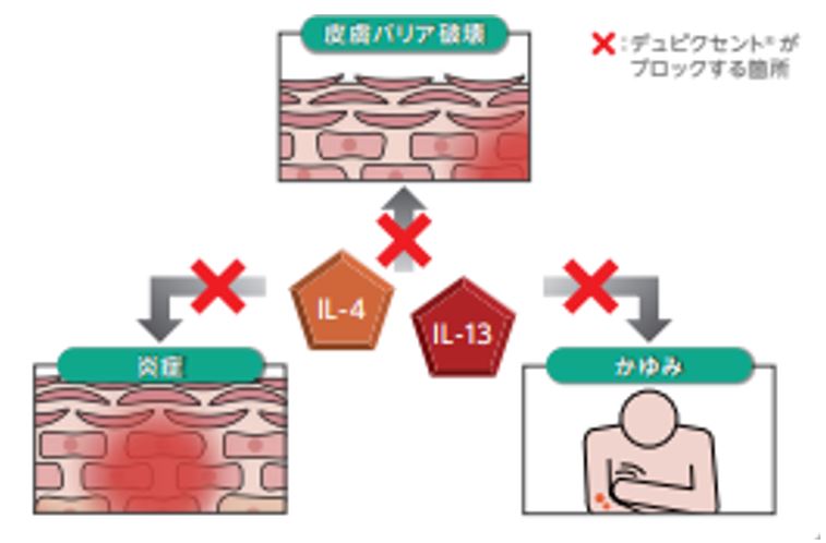 アトピー性皮膚炎の新しい治療法 公益財団法人 甲南会 甲南医療センター 旧 甲南病院