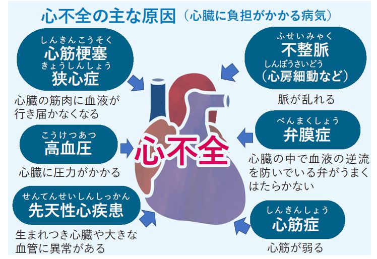 急性呼吸不全とは何ですか?